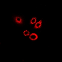 SERPINB1 Antibody - Immunofluorescent analysis of SerpinB1 staining in HeLa cells. Formalin-fixed cells were permeabilized with 0.1% Triton X-100 in TBS for 5-10 minutes and blocked with 3% BSA-PBS for 30 minutes at room temperature. Cells were probed with the primary antibody in 3% BSA-PBS and incubated overnight at 4 deg C in a humidified chamber. Cells were washed with PBST and incubated with a DyLight 594-conjugated secondary antibody (red) in PBS at room temperature in the dark.