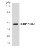 SERPINB12 Antibody - Western blot analysis of the lysates from HeLa cells using SERPINB12 antibody.
