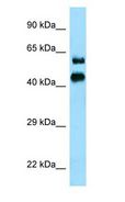 SERPINB12 Antibody - SERPINB12 antibody Western Blot of Human Small Intestine.  This image was taken for the unconjugated form of this product. Other forms have not been tested.