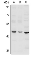 SERPINB12 Antibody - Western blot analysis of Serpin B12 expression in A549 (A), LO2 (B), AML12 (C) whole cell lysates.
