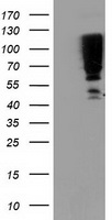 SERPINB13 / HUR7 Antibody - HEK293T cells were transfected with the pCMV6-ENTRY control (Left lane) or pCMV6-ENTRY SERPINB13 (Right lane) cDNA for 48 hrs and lysed. Equivalent amounts of cell lysates (5 ug per lane) were separated by SDS-PAGE and immunoblotted with anti-SERPINB13.