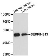 SERPINB13 / HUR7 Antibody - Western blot analysis of extracts of various cell lines, using SERPINB13 antibody at 1:3000 dilution. The secondary antibody used was an HRP Goat Anti-Rabbit IgG (H+L) at 1:10000 dilution. Lysates were loaded 25ug per lane and 3% nonfat dry milk in TBST was used for blocking. An ECL Kit was used for detection and the exposure time was 90s.