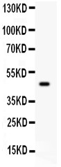 SERPINB2 / PAI-2 Antibody - SerpinB2 antibody Western blot. All lanes: Anti SerpinB2 at 0.5 ug/ml. WB: Human Placenta Tissue Lysate at 50 ug. Predicted band size: 47 kD. Observed band size: 47 kD.