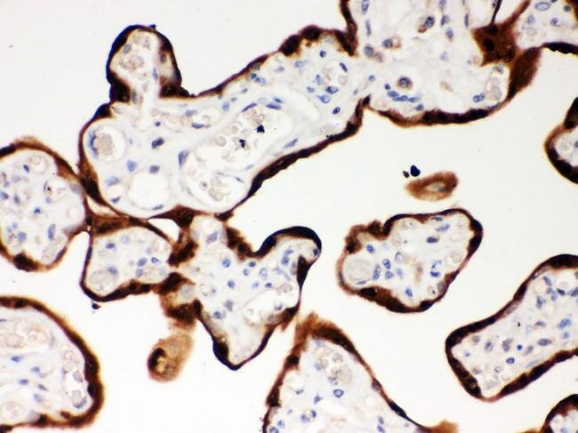 SERPINB2 / PAI-2 Antibody - SerpinB2 antibody IHC-paraffin: Human Placenta Tissue.