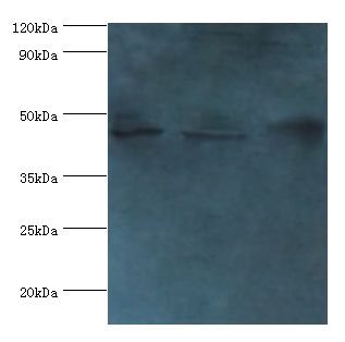 SERPINB2 / PAI-2 Antibody - Western blot. All lanes: Plasminogen activator inhibitor 2 type A antibody at 2 ug/ml. Lane 1: MCF-7 whole cell lysate Lane 2: 293T whole cell lysate Lane 3: mouse liver tissue. Secondary antibody: goat polyclonal to rabbit at 1:10000 dilution.  This image was taken for the unconjugated form of this product. Other forms have not been tested.