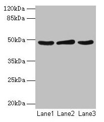 SERPINB2 / PAI-2 Antibody - Western blot All lanes: Plasminogen activator inhibitor 2 type A antibody at 2µg/ml Lane 1: MCF-7 whole cell lysate Lane 2: 293T whole cell lysate Lane 3: Mouse liver tissue Secondary Goat polyclonal to rabbit IgG at 1/10000 dilution Predicted band size: 47 kDa Observed band size: 47 kDa