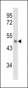 SERPINB2 / PAI-2 Antibody - Western blot of PAI2 antibody in NCI-H460 cell line lysates (35 ug/lane). PAI2 (arrow) was detected using the purified antibody.
