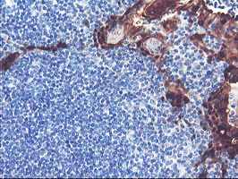 SERPINB2 / PAI-2 Antibody - IHC of paraffin-embedded Human tonsil using anti-SERPINB2 mouse monoclonal antibody.
