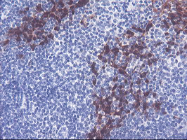 SERPINB2 / PAI-2 Antibody - IHC of paraffin-embedded Human tonsil using anti-SERPINB2 mouse monoclonal antibody.