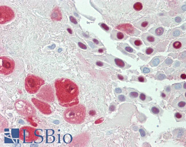 SERPINB2 / PAI-2 Antibody - Anti-SERPINB2 / PAI-2 antibody IHC staining of human placenta. Immunohistochemistry of formalin-fixed, paraffin-embedded tissue after heat-induced antigen retrieval. Antibody concentration 10 ug/ml.