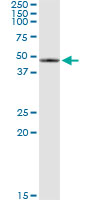 SERPINB2 / PAI-2 Antibody - Immunoprecipitation of SERPINB2 transfected lysate using anti-SERPINB2 monoclonal antibody and Protein A Magnetic Bead, and immunoblotted with SERPINB2 rabbit polyclonal antibody.