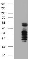 SERPINB2 / PAI-2 Antibody - HEK293T cells were transfected with the pCMV6-ENTRY control (Left lane) or pCMV6-ENTRY SERPINB2 (Right lane) cDNA for 48 hrs and lysed. Equivalent amounts of cell lysates (5 ug per lane) were separated by SDS-PAGE and immunoblotted with anti-SERPINB2.