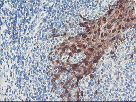 SERPINB2 / PAI-2 Antibody - IHC of paraffin-embedded Human tonsil using anti-SERPINB2 mouse monoclonal antibody. (Heat-induced epitope retrieval by 10mM citric buffer, pH6.0, 100C for 10min).
