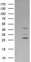 SERPINB2 / PAI-2 Antibody - HEK293T cells were transfected with the pCMV6-ENTRY control (Left lane) or pCMV6-ENTRY SERPINB2 (Right lane) cDNA for 48 hrs and lysed. Equivalent amounts of cell lysates (5 ug per lane) were separated by SDS-PAGE and immunoblotted with anti-SERPINB2.