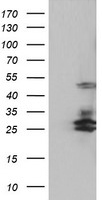 SERPINB2 / PAI-2 Antibody - HEK293T cells were transfected with the pCMV6-ENTRY control (Left lane) or pCMV6-ENTRY SERPINB2 (Right lane) cDNA for 48 hrs and lysed. Equivalent amounts of cell lysates (5 ug per lane) were separated by SDS-PAGE and immunoblotted with anti-SERPINB2.