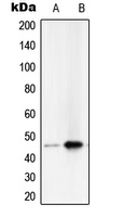 SERPINB2 / PAI-2 Antibody - Western blot analysis of PAI2 expression in HeLa (A); A431 (B) whole cell lysates.