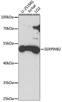 SERPINB2 / PAI-2 Antibody - Western blot analysis of extracts of various cell lines, using SERPINB2 antibody at 1:1000 dilution. The secondary antibody used was an HRP Goat Anti-Rabbit IgG (H+L) at 1:10000 dilution. Lysates were loaded 25ug per lane and 3% nonfat dry milk in TBST was used for blocking. An ECL Kit was used for detection and the exposure time was 90s.