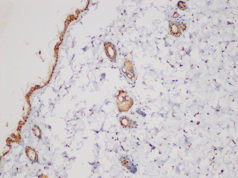 SERPINB2 / PAI-2 Antibody - Immunohistochemistry of paraffin-embedded Mouse skin using SERPINB2 Polycloanl Antibody at dilution of 1:200.