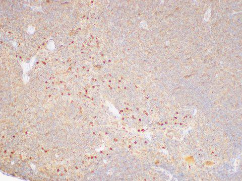 SERPINB2 / PAI-2 Antibody - Immunohistochemistry of paraffin-embedded Mouse spleen using SERPINB2 Polycloanl Antibody at dilution of 1:75.