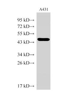 SERPINB2 / PAI-2 Antibody - Western Blot analysis of A431 cells using SERPINB2 Polyclonal Antibody at dilution of 1:1000.