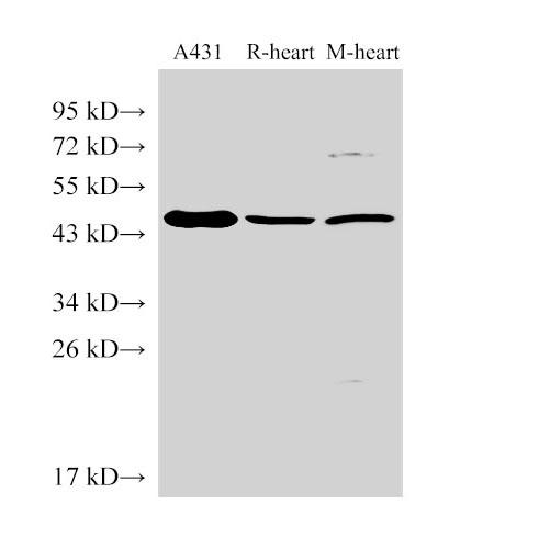 SERPINB2 / PAI-2 Antibody - Western Blot analysis of A431 cells, Rat heart and Mouse heart using SERPINB2 Polyclonal Antibody at dilution of 1:1000.