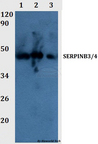 SERPINB3+4 Antibody - Western blot of SERPINB3/4 antibody at 1:500 dilution Line1:THP-1 whole cell lysate Line2:PC12 whole cell lysate Line3:sp20 whole cell lysate.