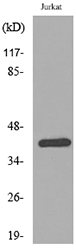 SERPINB3+4 Antibody - Western blot analysis of lysate from Jurkat cells, using SERPINB3/4 Antibody.