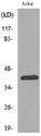 SERPINB3+4 Antibody - Western blot analysis of lysate from Jurkat cells, using SERPINB3/4 Antibody.