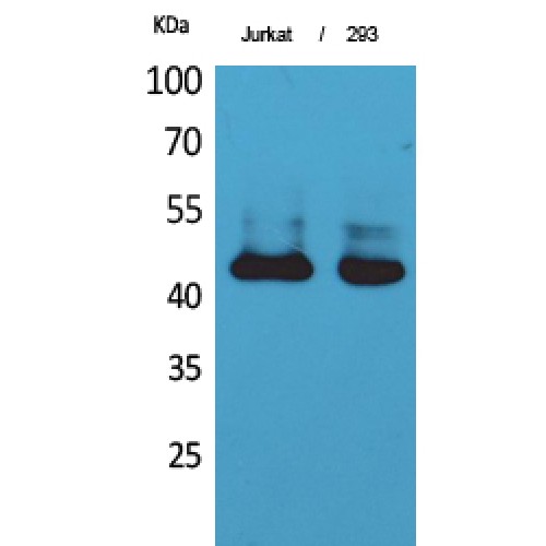 SERPINB3 Antibody - Western blot of SCCA1/2 antibody