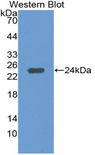 SERPINB3 Antibody - Western blot of recombinant SERPINB3 / SCCA-1.