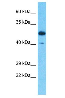 SERPINB3 Antibody - SERPINB3 / SCC antibody Western Blot of Thymus Tumor. Antibody dilution: 1 ug/ml.  This image was taken for the unconjugated form of this product. Other forms have not been tested.
