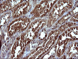 SERPINB3 Antibody - IHC of paraffin-embedded Human Kidney tissue using anti-SERPINB3 mouse monoclonal antibody. (Heat-induced epitope retrieval by 10mM citric buffer, pH6.0, 120°C for 3min).