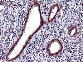 SERPINB3 Antibody - IHC of paraffin-embedded Human endometrium tissue using anti-SERPINB3 mouse monoclonal antibody. (Heat-induced epitope retrieval by 10mM citric buffer, pH6.0, 120°C for 3min).