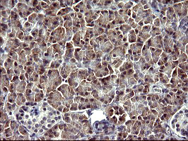 SERPINB3 Antibody - IHC of paraffin-embedded Human pancreas tissue using anti-SERPINB3 mouse monoclonal antibody. (Heat-induced epitope retrieval by 10mM citric buffer, pH6.0, 120°C for 3min).