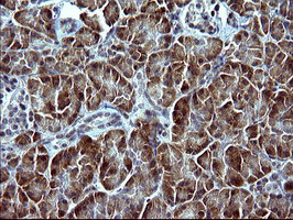 SERPINB3 Antibody - IHC of paraffin-embedded Human pancreas tissue using anti-SERPINB3 mouse monoclonal antibody. (Heat-induced epitope retrieval by 10mM citric buffer, pH6.0, 120°C for 3min).