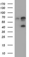 SERPINB3 Antibody - HEK293T cells were transfected with the pCMV6-ENTRY control (Left lane) or pCMV6-ENTRY SERPINB3 (Right lane) cDNA for 48 hrs and lysed. Equivalent amounts of cell lysates (5 ug per lane) were separated by SDS-PAGE and immunoblotted with anti-SERPINB3.