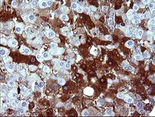 SERPINB3 Antibody - IHC of paraffin-embedded Human liver tissue using anti-SERPINB3 mouse monoclonal antibody. (Heat-induced epitope retrieval by 10mM citric buffer, pH6.0, 120°C for 3min).