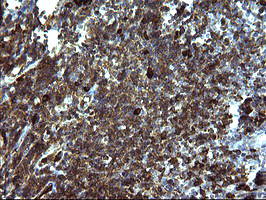 SERPINB3 Antibody - IHC of paraffin-embedded Human lymph node tissue using anti-SERPINB3 mouse monoclonal antibody. (Heat-induced epitope retrieval by 10mM citric buffer, pH6.0, 120°C for 3min).