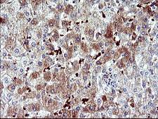 SERPINB3 Antibody - IHC of paraffin-embedded Human liver tissue using anti-SERPINB3 mouse monoclonal antibody. (Heat-induced epitope retrieval by 10mM citric buffer, pH6.0, 120°C for 3min).