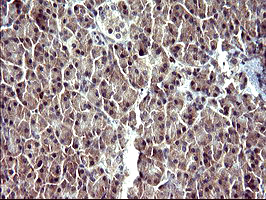 SERPINB3 Antibody - IHC of paraffin-embedded Human pancreas tissue using anti-SERPINB3 mouse monoclonal antibody. (Heat-induced epitope retrieval by 10mM citric buffer, pH6.0, 120°C for 3min).