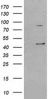 SERPINB3 Antibody - HEK293T cells were transfected with the pCMV6-ENTRY control (Left lane) or pCMV6-ENTRY SERPINB3 (Right lane) cDNA for 48 hrs and lysed. Equivalent amounts of cell lysates (5 ug per lane) were separated by SDS-PAGE and immunoblotted with anti-SERPINB3.