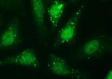 SERPINB3 Antibody - Immunofluorescent staining of HeLa cells using anti-SERPINB3 mouse monoclonal antibody.