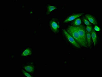 SERPINB3 Antibody - Immunofluorescence staining of A549 cells with SERPINB3 Antibody at 1:150, counter-stained with DAPI. The cells were fixed in 4% formaldehyde, permeabilized using 0.2% Triton X-100 and blocked in 10% normal Goat Serum. The cells were then incubated with the antibody overnight at 4°C. The secondary antibody was Alexa Fluor 488-congugated AffiniPure Goat Anti-Rabbit IgG(H+L).