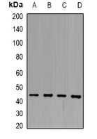 SERPINB3 Antibody - Western blot analysis of SCCA1 expression in HeLa (A); HepG2 (B); HEK293T (C); SHSY5Y (D) whole cell lysates.