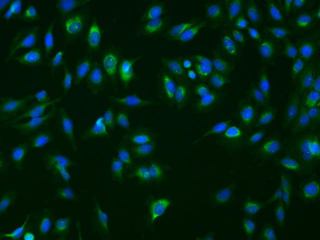 SERPINB3 Antibody - Immunofluorescence staining of SERPINB3 in HeLa cells. Cells were fixed with 4% PFA, permeabilzed with 0.1% Triton X-100 in PBS, blocked with 10% serum, and incubated with rabbit anti-Human SERPINB3 polyclonal antibody (dilution ratio 1:200) at 4°C overnight. Then cells were stained with the Alexa Fluor 488-conjugated Goat Anti-rabbit IgG secondary antibody (green) and counterstained with DAPI (blue). Positive staining was localized to Cytoplasm.