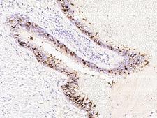 SERPINB3 Antibody - Immunochemical staining of human SERPINB3 in human bronchus with rabbit polyclonal antibody at 1:1000 dilution, formalin-fixed paraffin embedded sections.