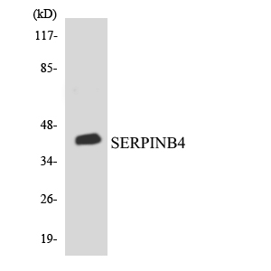 SERPINB4 / SCCA1+2 Antibody - Western blot analysis of the lysates from COLO205 cells using SERPINB4 antibody.