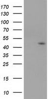 SERPINB4 / SCCA1+2 Antibody - HEK293T cells were transfected with the pCMV6-ENTRY control (Left lane) or pCMV6-ENTRY SERPINB4 (Right lane) cDNA for 48 hrs and lysed. Equivalent amounts of cell lysates (5 ug per lane) were separated by SDS-PAGE and immunoblotted with anti-SERPINB4.