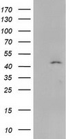 SERPINB4 / SCCA1+2 Antibody - HEK293T cells were transfected with the pCMV6-ENTRY control (Left lane) or pCMV6-ENTRY SERPINB4 (Right lane) cDNA for 48 hrs and lysed. Equivalent amounts of cell lysates (5 ug per lane) were separated by SDS-PAGE and immunoblotted with anti-SERPINB4.