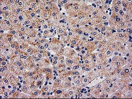 SERPINB4 / SCCA1+2 Antibody - IHC of paraffin-embedded Human liver tissue using anti-SERPINB4 mouse monoclonal antibody.